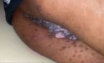 University Of Lagos Student Records Infected Pussy On Friday Night